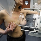 5 Formas de prevenir el cancer de mamas 6.jpg