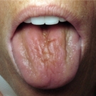 6 sorpresivas cosas que pueden dañar tus dientes_boca seca.jpg