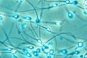 La eyaculación recurrente mejora los espermatozoides La eyaculación recurrente mejora los espermatozoides