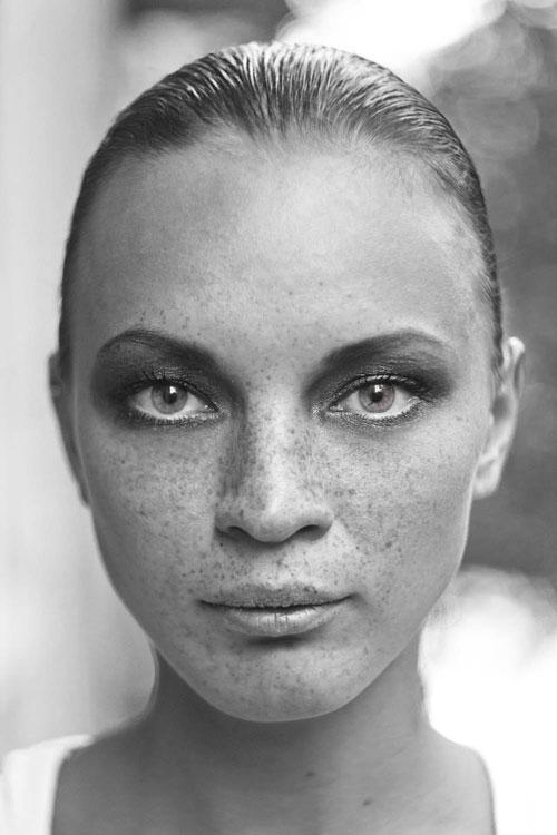 piel con pecas