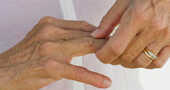 Aromaterapia para la artritis ¿es una opción valida?