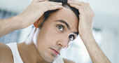Como frenar la caída del cabello en hombres según expertos