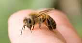 Como tratar una picadura de abeja con remedios caseros