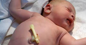 Cordon umbilical bebé recien nacido