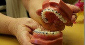 Tratamientos de Ortodoncia dental