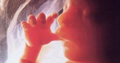 Los fetos pueden sentir dolor a las 20 semanas después de la concepción