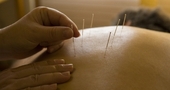 Puntos de acupuntura para bajar de peso