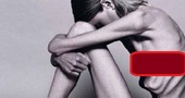 Bulimia y Anorexia: Un mal que nos afecta a todos